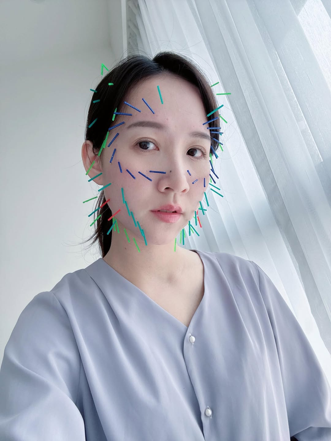 ｜我把化妝品淘汰了一大半，自從規律美顏針灸｜