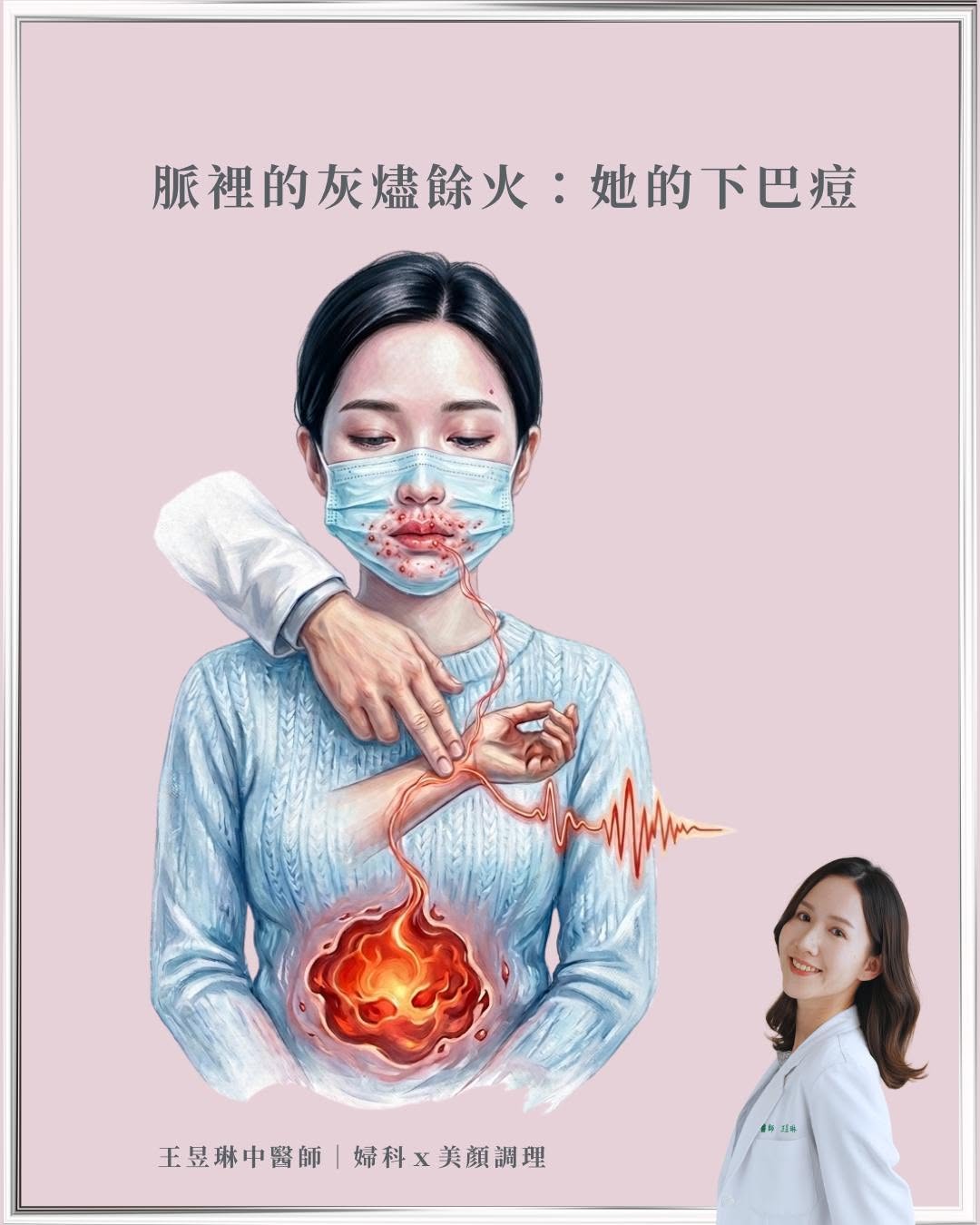 ｜脈裡的灰燼餘火：她的下巴痘｜