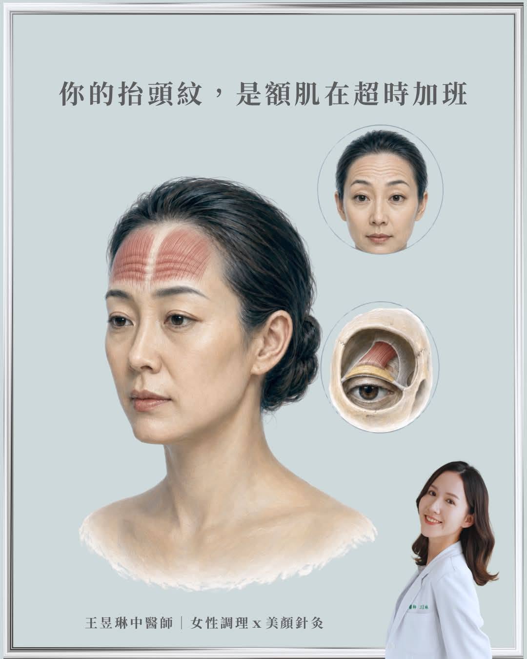 ｜為什麼打完肉毒會眉壓眼：你的抬頭紋，是額肌在超時加班｜