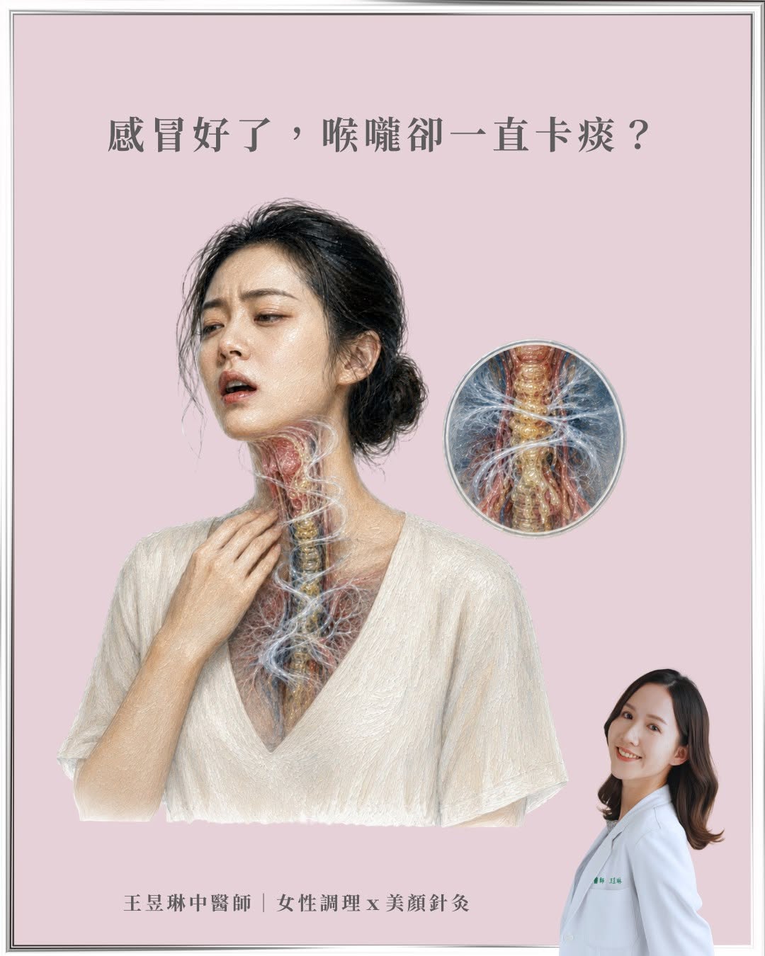 |感冒明明好了,為什麼喉嚨一直卡痰?|